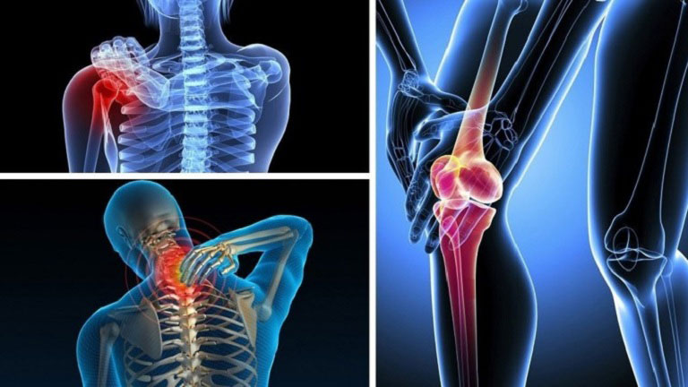 Nguyên nhân gây bệnh xương khớp